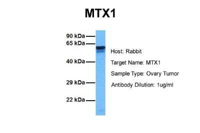 Western Blot: Metaxin 1 Antibody [NBP1-59449]