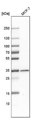 Western Blot: Metaxin 1 Antibody [NBP1-87741]