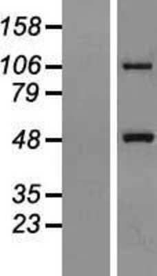 Western Blot: Metaxin 1 Overexpression Lysate [NBL1-13388]