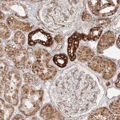 Immunohistochemistry-Paraffin: Metaxin-2 Antibody [NBP1-87435]