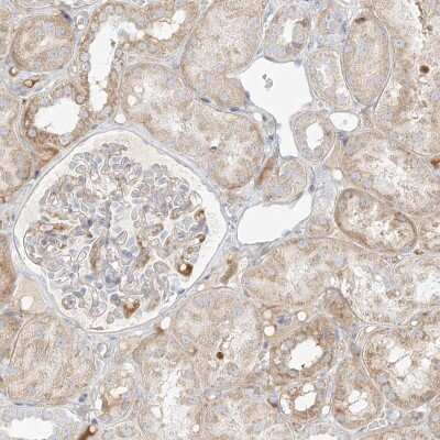 Immunohistochemistry-Paraffin: Metaxin-2 Antibody [NBP1-87436]