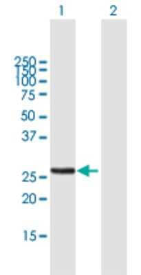 Western Blot: Metaxin-2 Antibody [H00010651-B01P]