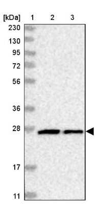 Western Blot: Metaxin-2 Antibody [NBP1-87434]