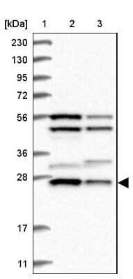 Western Blot: Metaxin-2 Antibody [NBP1-87435]