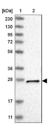 Western Blot: Metaxin-2 Antibody [NBP1-87436]