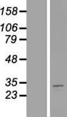 Western Blot: Metaxin-2 Overexpression Lysate [NBL1-13389]