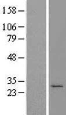 Western Blot: Metaxin-2 Overexpression Lysate [NBL1-13390]