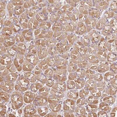 Immunohistochemistry-Paraffin: Methionine Aminopeptidase 1/METAP1 Antibody [NBP2-38375]