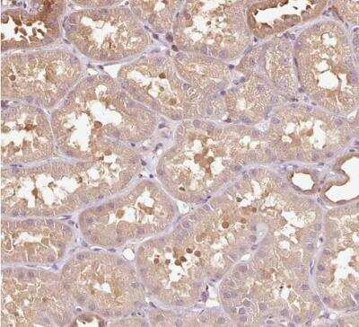 Immunohistochemistry-Paraffin: Methionine Aminopeptidase 1/METAP1 Antibody [NBP2-38375]