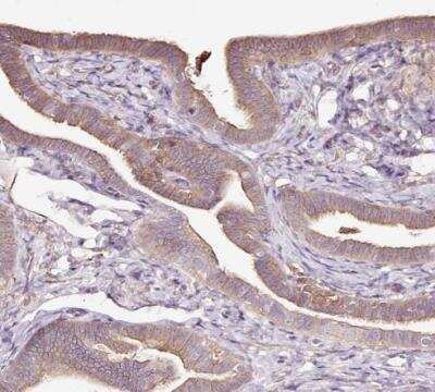 Immunohistochemistry-Paraffin: Methionine Aminopeptidase 1/METAP1 Antibody [NBP2-38375]