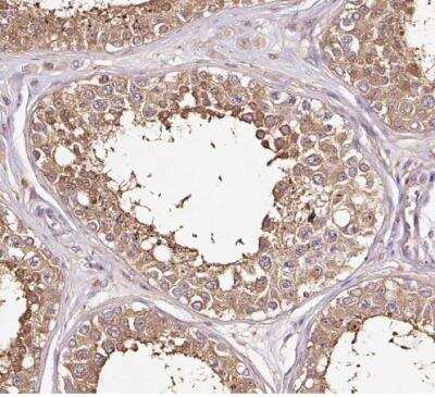 Immunohistochemistry-Paraffin: Methionine Aminopeptidase 1/METAP1 Antibody [NBP2-38375]