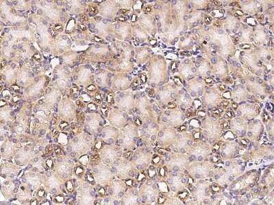 Immunohistochemistry-Paraffin: Methionine Aminopeptidase 2/METAP2 Antibody (001) [NBP2-90622]