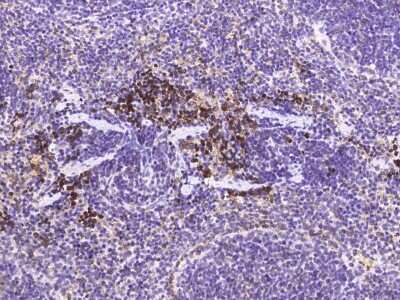 Immunohistochemistry-Paraffin: Methionine Aminopeptidase 2/METAP2 Antibody (001) [NBP2-90622]