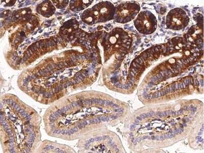 Immunohistochemistry-Paraffin: Methionine Aminopeptidase 2/METAP2 Antibody (001) [NBP2-90622]