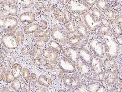 Immunohistochemistry-Paraffin: Methionine Aminopeptidase 2/METAP2 Antibody [NBP2-98941]