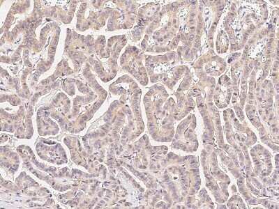 Immunohistochemistry-Paraffin: Methionine Aminopeptidase 2/METAP2 Antibody [NBP2-98941]