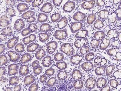 Immunohistochemistry-Paraffin: Methionine Aminopeptidase 2/METAP2 Antibody [NBP2-98941]