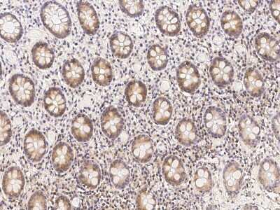 Immunohistochemistry-Paraffin: Methionine Aminopeptidase 2/METAP2 Antibody [NBP2-99115]