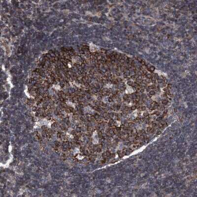Immunohistochemistry-Paraffin: Methionine Aminopeptidase 2/METAP2 Antibody [NBP3-05513]