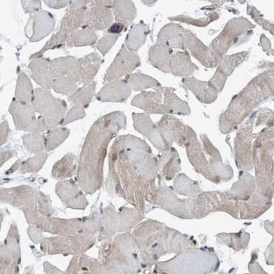 Immunohistochemistry-Paraffin: Methionine Aminopeptidase 2/METAP2 Antibody [NBP3-05513]