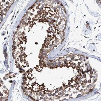 Immunohistochemistry-Paraffin: Methionine Aminopeptidase 2/METAP2 Antibody [NBP3-05513]