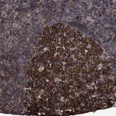 Immunohistochemistry-Paraffin: Methionine Aminopeptidase 2/METAP2 Antibody [NBP3-05513]