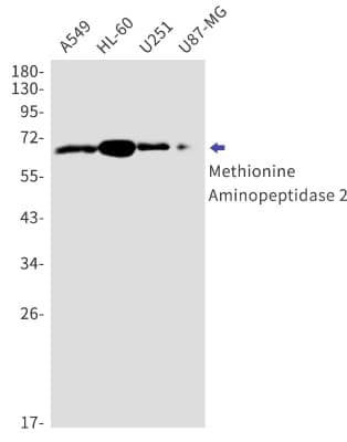 Western Blot: Methionine Aminopeptidase 2/METAP2 Antibody (S07-6C1) [NBP3-19889]