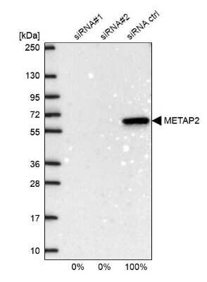 Western Blot: Methionine Aminopeptidase 2/METAP2 Antibody [NBP3-05513]