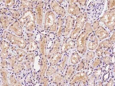 Immunohistochemistry-Paraffin: Methionine Sulfoxide Reductase A Antibody [NBP2-97475]