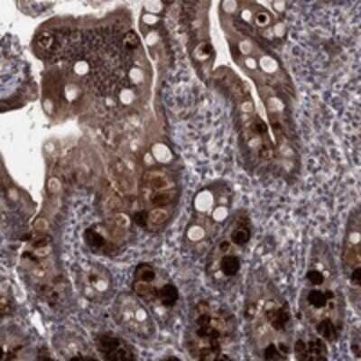 Immunohistochemistry-Paraffin: Methionine Sulfoxide Reductase A Antibody [NBP3-17739]