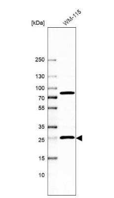 Western Blot: Methionine Sulfoxide Reductase A Antibody [NBP1-87456]