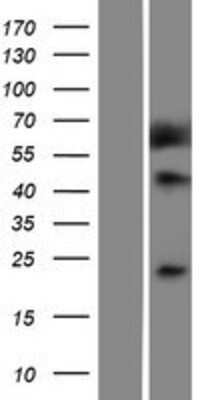 Western Blot: Methionine Sulfoxide Reductase A Overexpression Lysate [NBP2-11090]