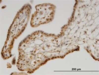 Immunohistochemistry-Paraffin: Methionine Sulfoxide Reductase B Antibody (8B2) [H00051734-M02]