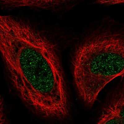 Immunocytochemistry/ Immunofluorescence: Methionine Sulfoxide Reductase B Antibody [NBP2-57316]