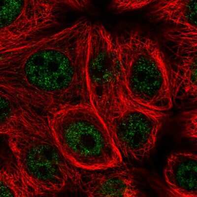 Immunocytochemistry/ Immunofluorescence: Methionine Sulfoxide Reductase B Antibody [NBP2-58741]