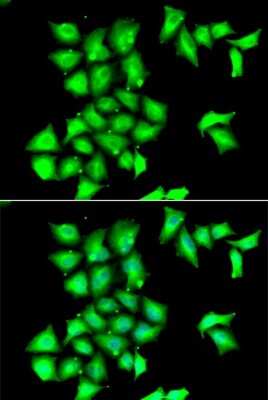 Immunocytochemistry/ Immunofluorescence: Methionine Sulfoxide Reductase B Antibody - BSA Free [NBP3-03548]