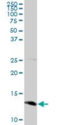 Western Blot: Methionine Sulfoxide Reductase B Antibody [H00051734-D01P]