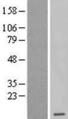 Western Blot: Methionine Sulfoxide Reductase B Overexpression Lysate [NBL1-15819]