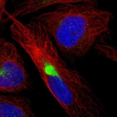 Immunocytochemistry/ Immunofluorescence: Methionyl tRNA synthetase 2 Antibody [NBP1-92106]