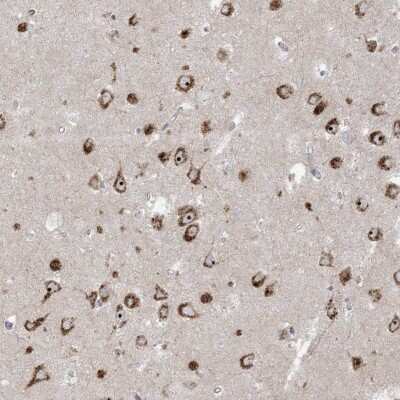 Immunohistochemistry: Methionyl tRNA synthetase 2 Antibody [NBP2-34013]