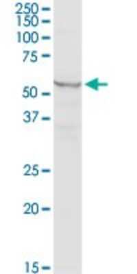 Western Blot: Methionyl tRNA synthetase 2 Antibody [H00092935-D01P]