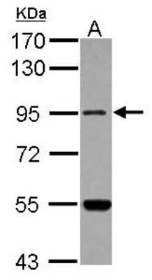 Western Blot: Methionyl tRNA synthetase 2 Antibody [NBP2-17279]