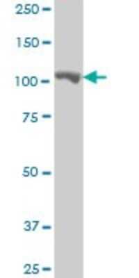 Western Blot: Methionyl tRNA synthetase Antibody (5G5) [H00004141-M01]