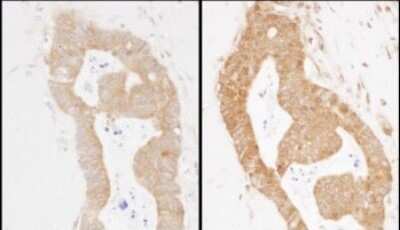 Immunohistochemistry: Methionyl tRNA synthetase Antibody [NBP2-22313]