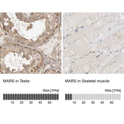 Immunohistochemistry-Paraffin: Methionyl tRNA synthetase Antibody [NBP1-87730]