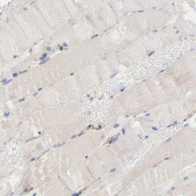 Immunohistochemistry-Paraffin: Methionyl tRNA synthetase Antibody [NBP1-87730]