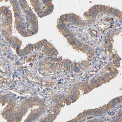 Immunohistochemistry-Paraffin: Methionyl tRNA synthetase Antibody [NBP1-87730]