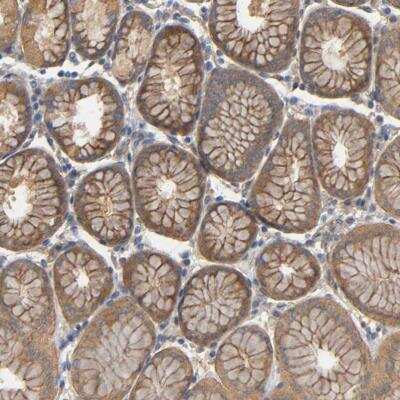 Immunohistochemistry-Paraffin: Methionyl tRNA synthetase Antibody [NBP1-87730]