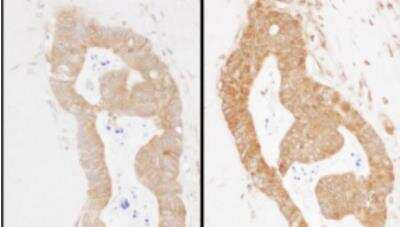 Immunohistochemistry-Paraffin: Methionyl tRNA synthetase Antibody [NBP2-22312]