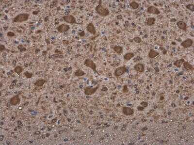 Immunohistochemistry-Paraffin: Methionyl tRNA synthetase Antibody [NBP3-13217]